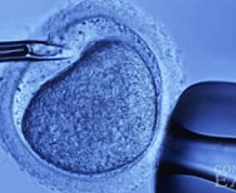 In Vitro Fertilization (IVF): How You Can Prepare Using These 3 Tips