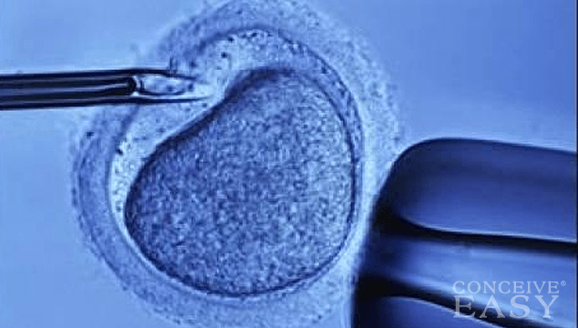 In Vitro Fertilization (IVF): How You Can Prepare Using These 3 Tips