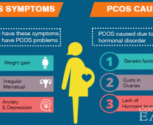 PCOS and Getting Pregnant