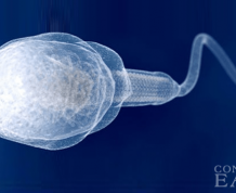 Treatment for Male Infertility