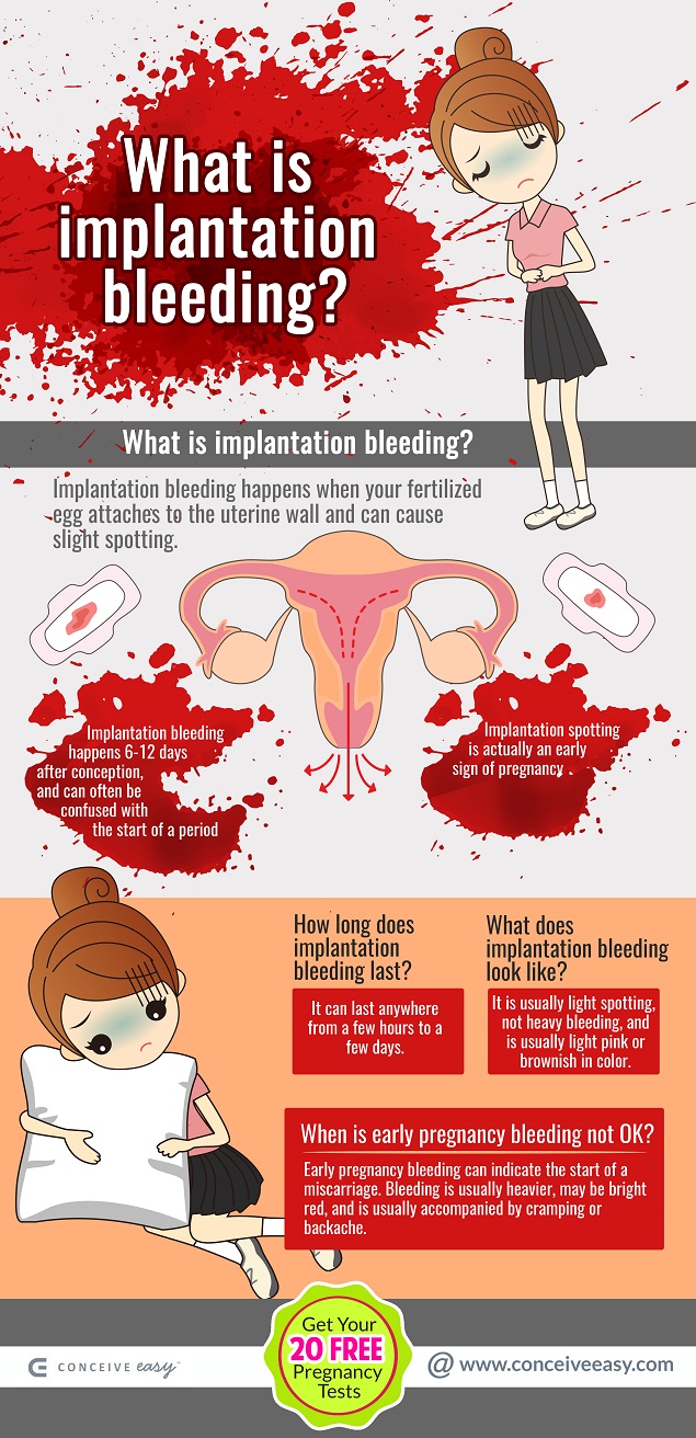 Implantation Bleeding or Early Pregnancy Bleeding Infographic