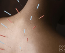 Acupuncture for Fertility and Early Pregnancy