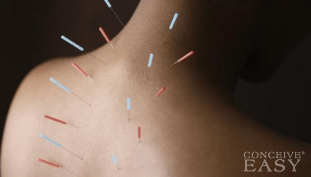 Acupuncture for Fertility and Early Pregnancy