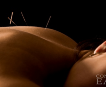 Acupuncture and Infertility