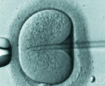 Gamete Intra-Fallopian Transfer (GIFT) and Zygote Intra-Fallopian Transfer (ZIFT)