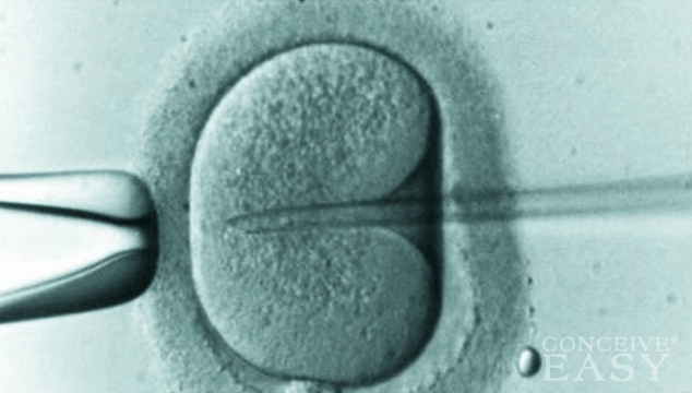 Gamete Intra-Fallopian Transfer (GIFT) and Zygote Intra-Fallopian Transfer (ZIFT)