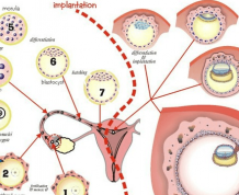 What Is Implantation Bleeding?