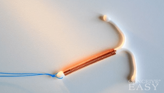 Intrauterine Device (IUD) Information