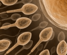 Varicocele and Male Infertility