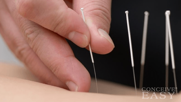 Acupuncture for Fertility Treatment