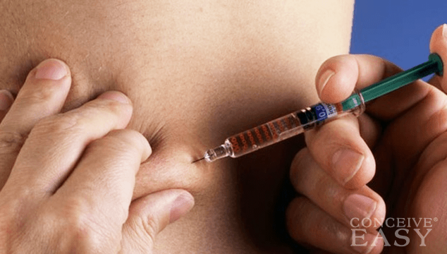 How to Give an HCG Injection