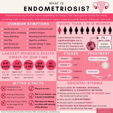 endometriosis