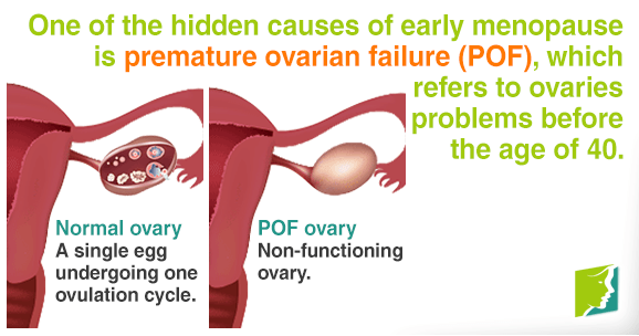 premature ovarian failure