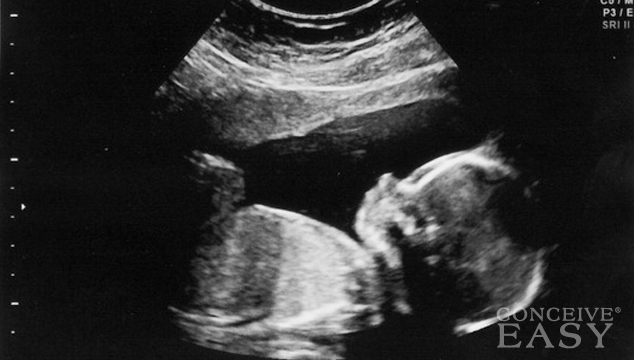 Preconception Tips for Preventing Birth Defects