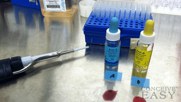 Blood Type and Rh Factor