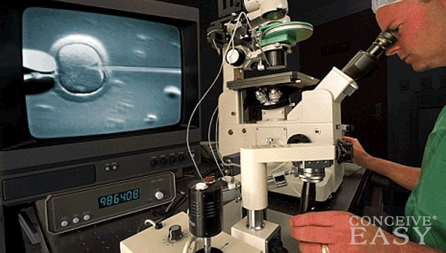 What Is Intracytoplasmic Sperm Injection (ICSI)?