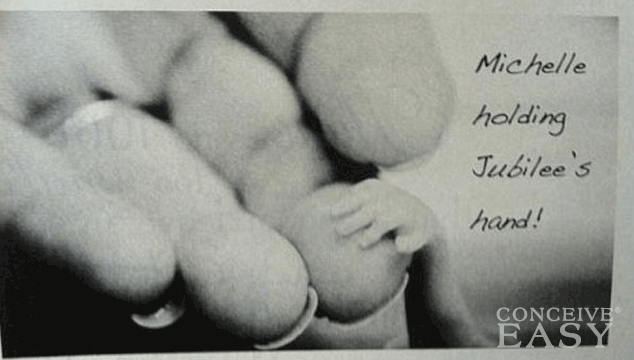 Coping With Stillbirth and Late Term Pregnancy Loss