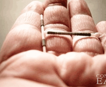 How Long to Get Pregnant After IUD Removal?