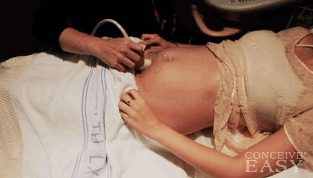 Is Having An Ultrasound Safe For the Baby?