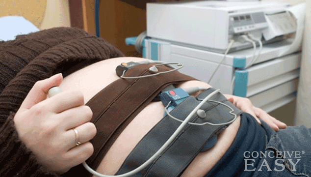 What is the Non-Stress Test?