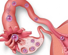 What Are Implantation Symptoms?