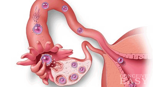 What Are Implantation Symptoms?