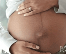 Birth Lines on a Pregnant Woman's Stomach