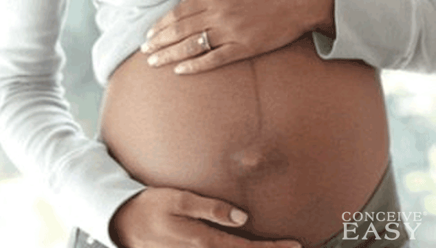 Birth Lines on a Pregnant Woman's Stomach
