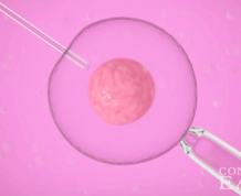 Does IVF after Tubal Ligation Work?