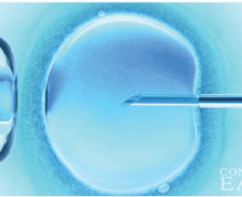 What Is It Like to Get Fertility Treatment for Pregnancy?