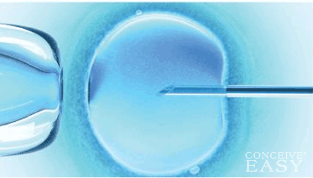 What Is It Like to Get Fertility Treatment for Pregnancy?