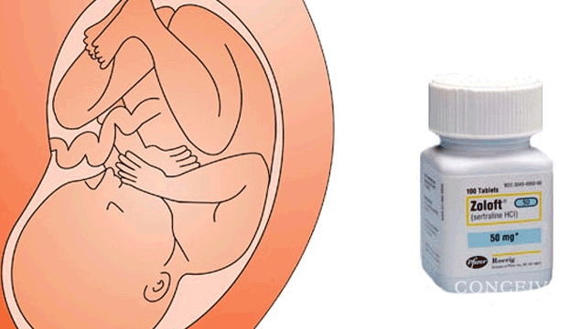 Can Zoloft Harm a Baby While Pregnant?
