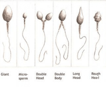 How Do You Know When He Should be Tested for Infertility?