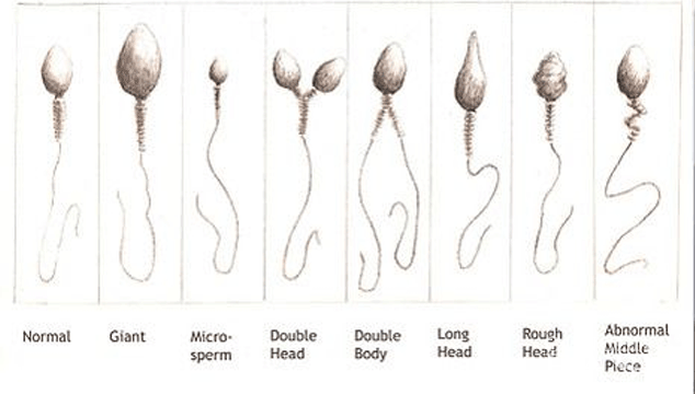 How Do You Know When He Should be Tested for Infertility?