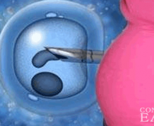 How Often is Assisted Reproductive Technology (ART) Successful?