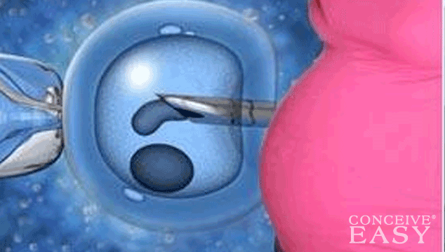 How Often is Assisted Reproductive Technology (ART) Successful?