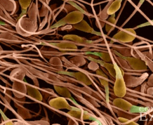 Top 10 Sperm-Killers