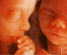 What is the Average Week During Pregnancy Twins are Born?