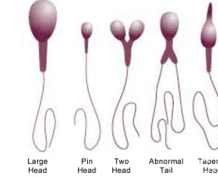 Does a Semen Analysis Compare to Female Fertility Tests?
