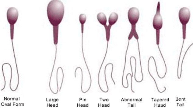 Does a Semen Analysis Compare to Female Fertility Tests?