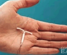More U.S. Women Choosing IUDs for Birth Control