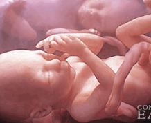 What are the Chances of Having Twins with Clomid?