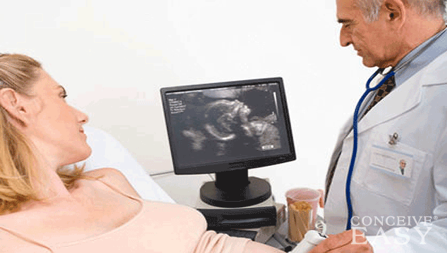 Prenatal Diagnosis: Amnio and CVS