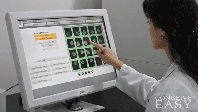 What is Early Embryo Viability Test (Eeva)?
