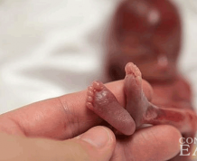 Signs of Miscarriage