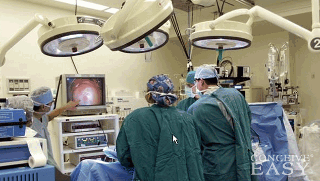 How to Get Pregnant Fast after Laparoscopy?