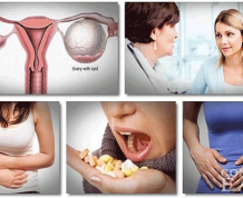 Home Remedies for Ovarian Cysts