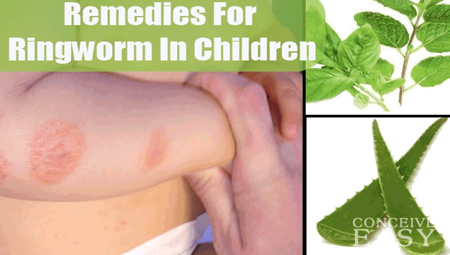 Home Remedies for Toddler Ringworm