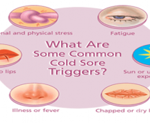 How to Treat Children's Cold Sores