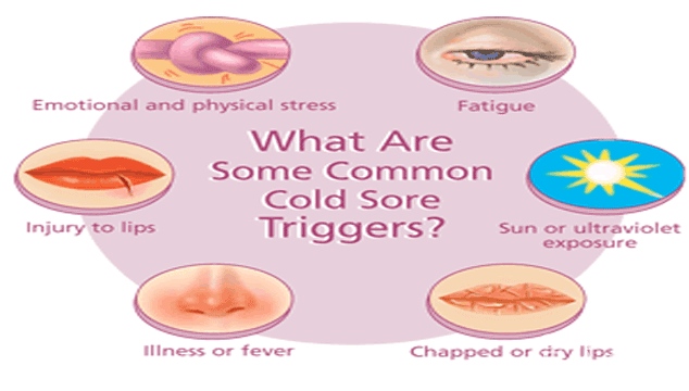 How to Treat Children's Cold Sores